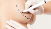 Augmentation mammaire avec implants